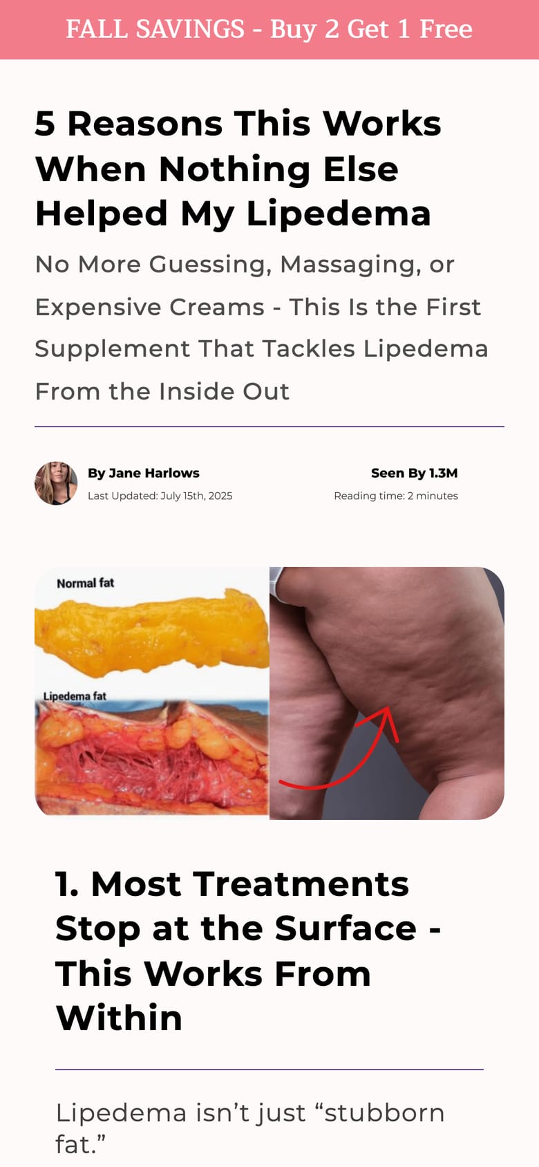 landing page capture